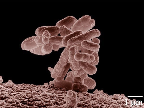 Research shows alternating antibiotics could make resistant bacteria beatable
