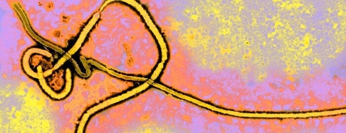 UTMB researchers develop Ebola vaccine effective in a single dose