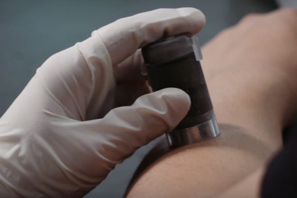 Thank 3D Printing for a Painless Flu Shot