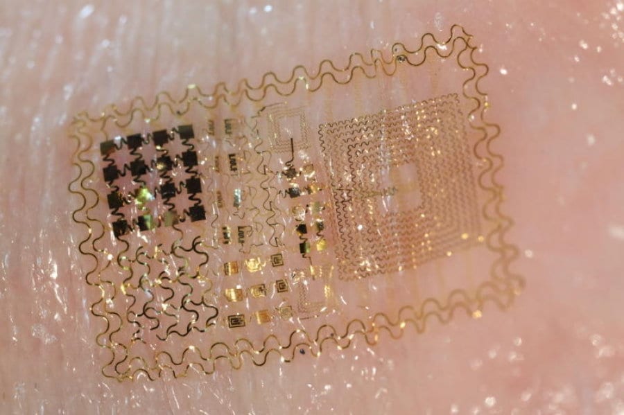 E-skin and pocket-sized diagnostic machines give patients the power back