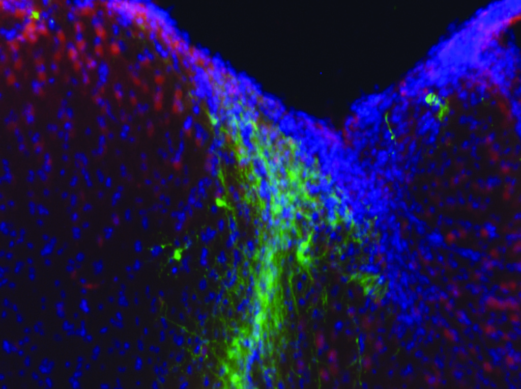 In another part of the study, cells were injected into damaged parts of the brain (pictured), enhancing motor coordination within weeks.