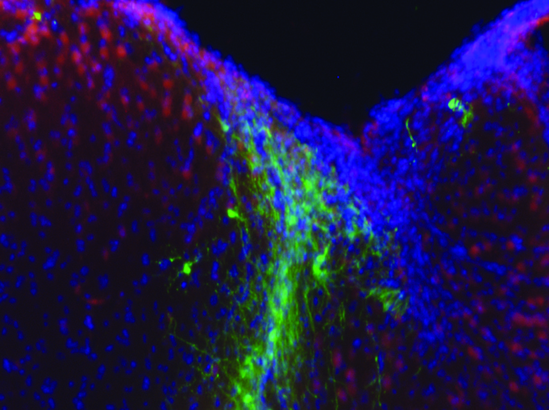 Hydrogels boost ability of stem cells to restore eyesight and heal brains