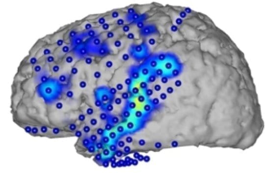 Speech recognition from brain activity