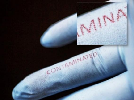Inkjet Inks Made of Bioactive Silk Could Yield Smart Bandages, Bacteria-Sensing Surgical Gloves & More
