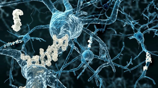 Scientists Develop Antibody to Treat Traumatic Brain Injury and Prevent Long-Term Neurodegeneration