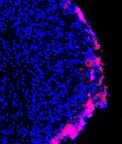 Stem Cells Provide Lasting Pain Relief in Mice