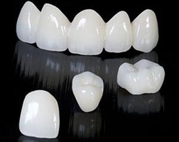 Chinese researchers make breakthrough in SLA 3D printing, soon be able to 3D print porcelain teeth in minutes