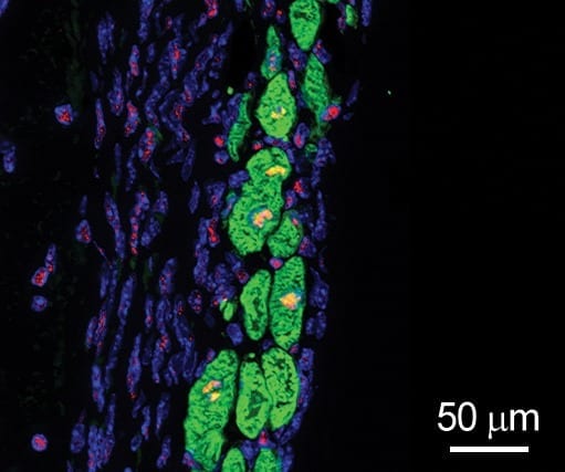 New heart muscle cells (green with yellow nuclei) grow in the infarcted region of a mouse heart treated by the patch loaded with FSTL1.