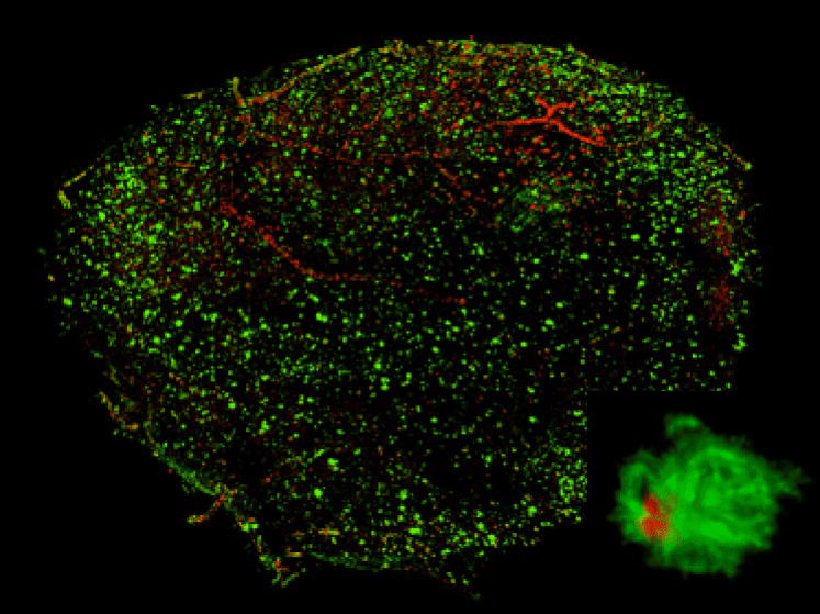 3D visualization of A? plaques in entire hemispheres of an AD model mouse, stained with PP-BTA-1 (red) and Alexa488-6E10 (green). 18 months of age. Inset, a high-magnification volume rendering of a representative senile plaque.