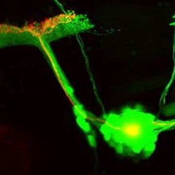 Repairing neurons with light