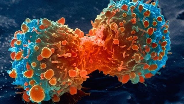New way to find cancer ‘hidden’ amongst billions of healthy cells