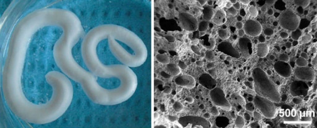 This new injectable foam can repair and regrow degenerating bones