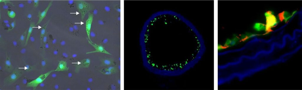 On the left are fluorescence-labeled cells with nanoparticles: The cellular nuclei are shown in blue, the fluorescence labeling is shown in green and the nanoparticles in the cells are identified by arrows. The middle photo shows a blood vessel populated with these cells (green). On the right is a detailed image of a vascular wall with the eNOS protein identified (red). © Photo: Dr. Sarah Rieck/Dr. Sarah Vosen/University of Bonn