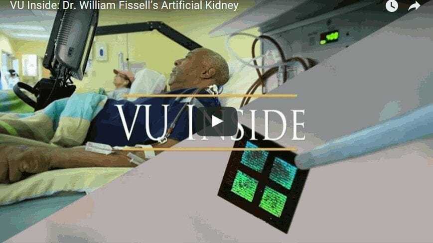 First Implantable Artificial Kidney with a Microchip