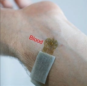 A wearable blood-flow sensor for vascular disease monitoring