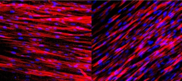 Staining on these slides shows that engineered human arteries produce contractile proteins (left) and calponin (right) just one week after being grown in culture. These two molecules allow the arteries to contract and dilate in response to environmental stimuli.