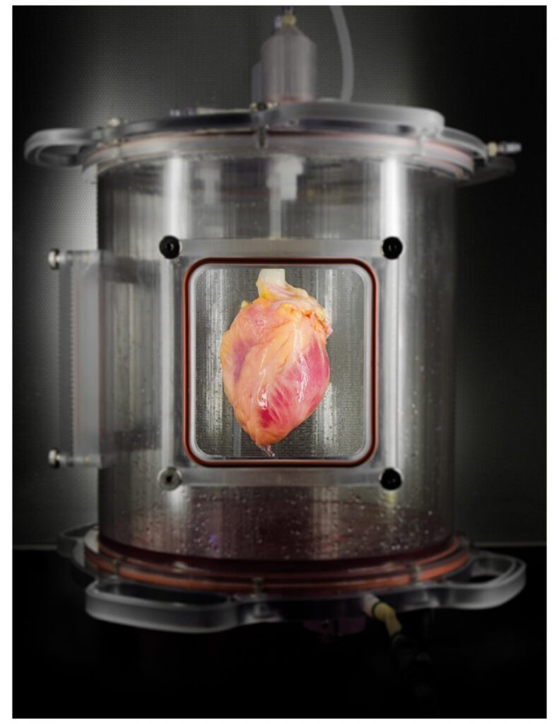 A partially recellularized human whole-heart cardiac scaffold, reseeded with human cardiomyocytes derived from induced pluripotent stem cells, being cultured in a bioreactor that delivers a nutrient solution and replicates some of the environmental conditions around a living heart. CREDIT Bernhard Jank, MD, Ott Lab, Center for Regenerative Medicine, Massachusetts General Hospital