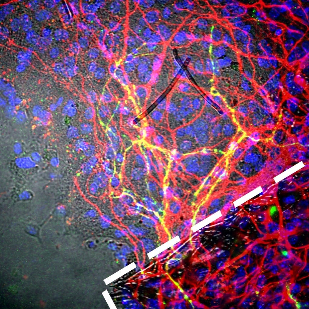 Future Brain Therapies for Parkinson's Possible with Stem Cell Bioengineering Innovation