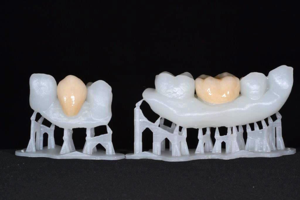 Additive manufacturing: A printed smile