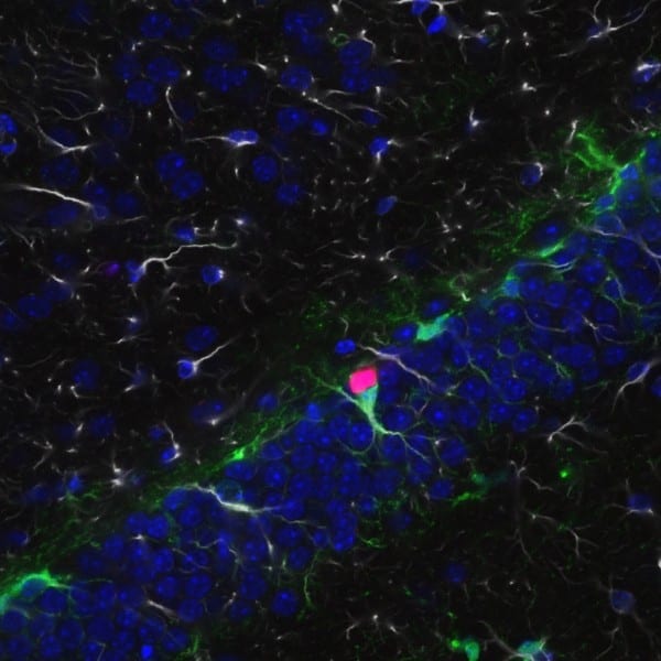 Image: Yue Li This confocal microscope image shows neural stem cells (green) in the mouse hippocampus actively proliferating because they express FMRP (red), a protein that causes cells to differentiate and grow. The hippocampus is vital to forming new memories in mice and people. Scale bar: 20 microns. 