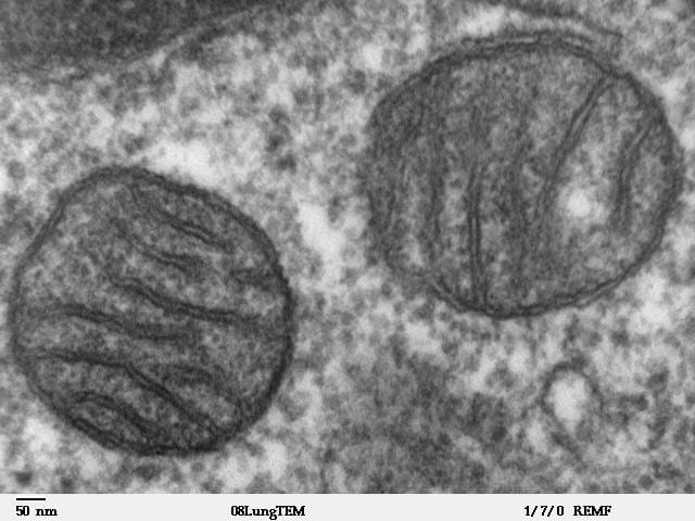 This image shows the mitochondria of a mammal. CREDIT Louisa Howard
