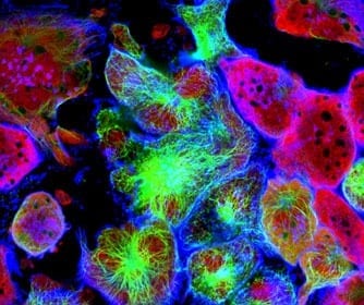 New, non-invasive method to wipe out cancerous tumors using chemistry and light