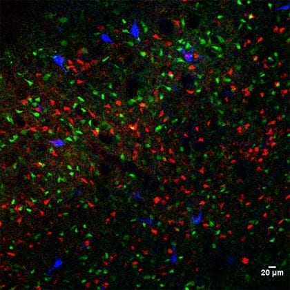 A genetically altered mouse that excessively washes its face shows an imbalance in brain activity involved in compulsive behavior. Cells responsible for driving particular behaviors are more active in these mice. A Duke study found that blocking a brain receptor called mGluR5 restores the balance of activity between these so-called ‘go’ cells (red) and the cells that inhibit action, which are labeled in green. Photo by Kristen Ade/Duke University