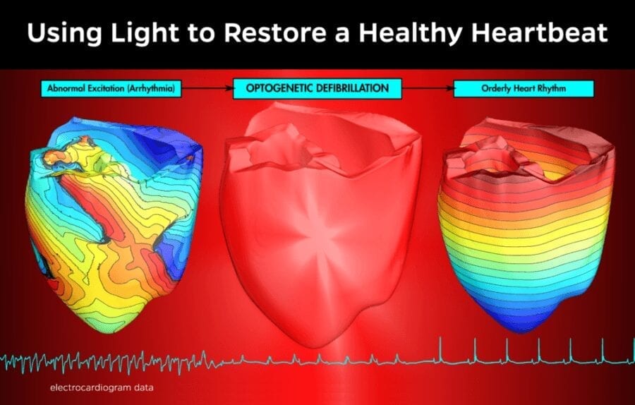 Light Instead of Electric Shock Tames Lethal Heart Disorders in Mice and Virtual Humans