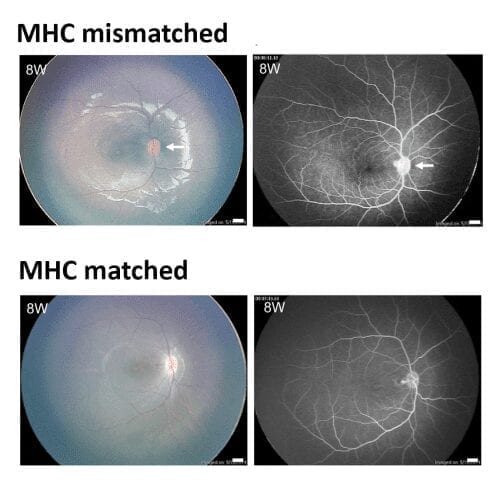 Success! iPSC-derived retinal cells from one monkey transplanted into another without rejection