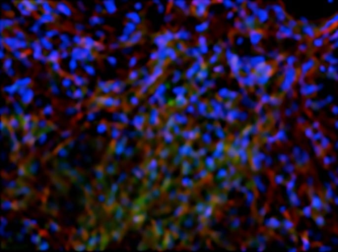 Stained image of stem-cell-derived osteoblasts. Credit: Varghese Lab/UC San Diego