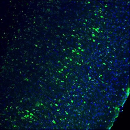 Pictured is a part of the adult mouse brain. Cell nuclei are blue and genome-edited neurons are green. Click here for a high-resolution image Credit: Salk Institute