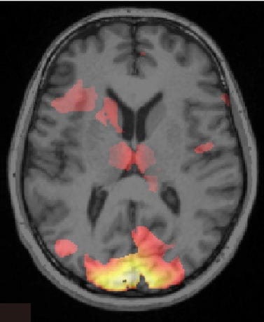 Scan of brain showing information associated with a fear memory Credit Ai Koizumi