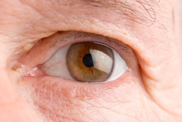 Revolutionizing eye cancer treatment by initiating cancer ‘cell-suicide’
