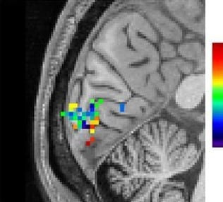 Tracking brain activity during human thought