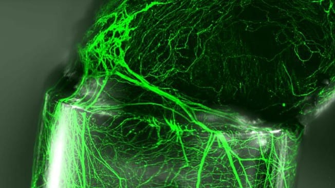 Nanometric imprinting on fiber could help nerve regeneration, artificial tissue creation and smart bandages