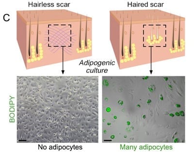 Discovery allows wounds heal as regenerated skin rather than scar tissue