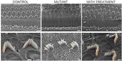 Hearing restored down to a whisper in deaf mice via gene therapy