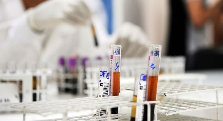 Diagnosing and locating cancer from a blood sample