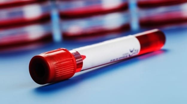 A blood test for detecting cancer?