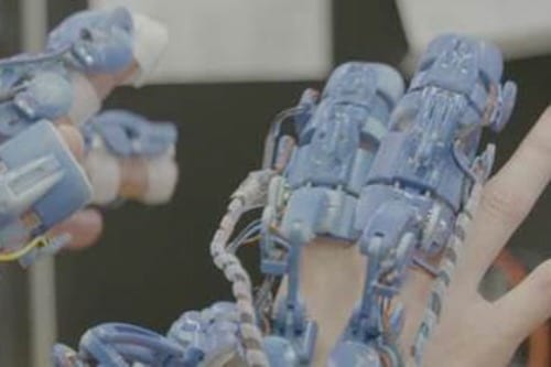 A wearable robotic system for minimally invasive surgery