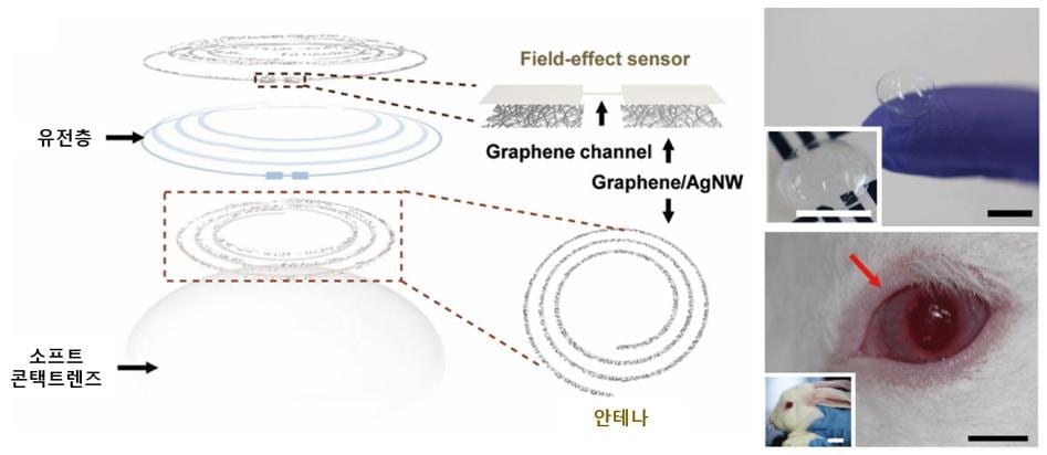 Diagnosing diabetes and glaucoma with a smart contact lens