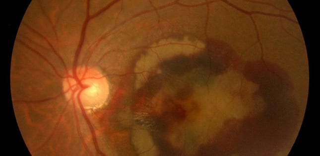 Studying retinal diseases on a chip means animal models may not be needed