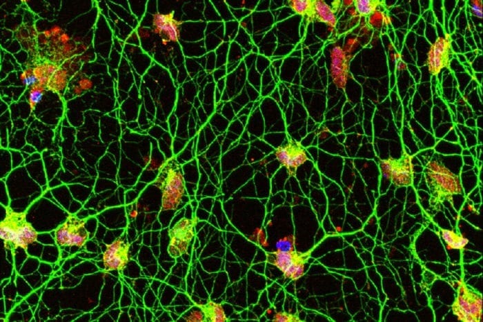 Motor neurons created directly from human skin cells