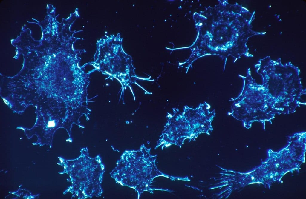 Any cancer cell could be killed by suicide molecules - a major breakthrough?