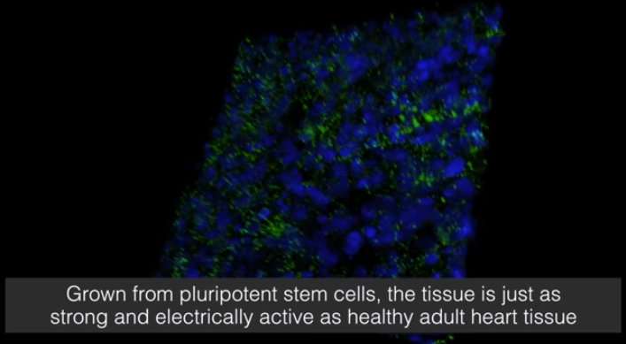 A fully functioning artificial human heart muscle large enough to patch over typical heart damage