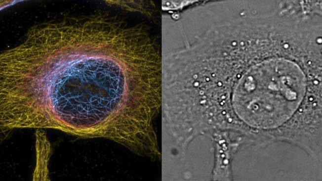 Super resolution microscopy captures unprecedented views inside living cells
