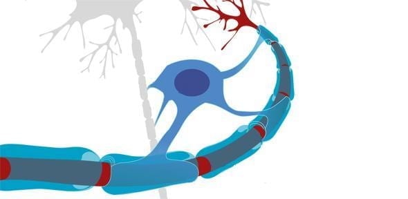 Personalised stem cell treatment may offer relief for progressive MS