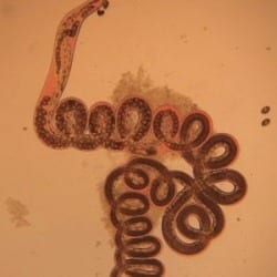Could parasitic worms be frenemies with benefits to help treat obesity and more?