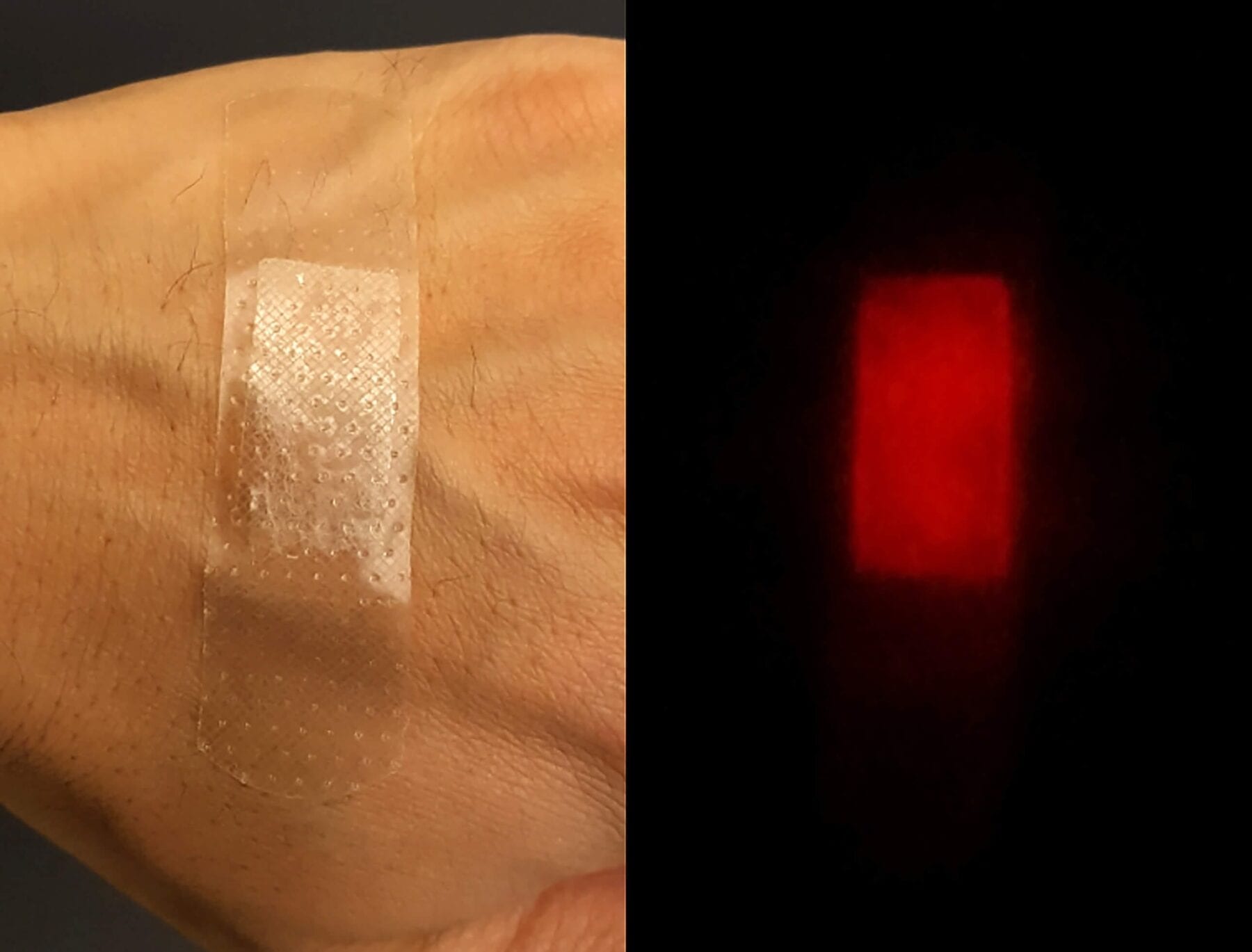 Fluorescent silk as an implantable and injectable wound healing material