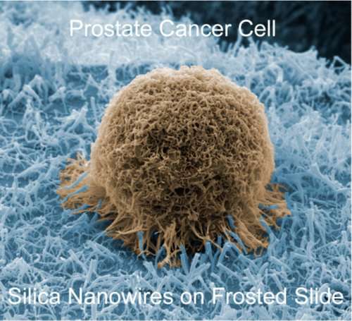 A new type of sensor acts like Velcro® for prostate cancer cells